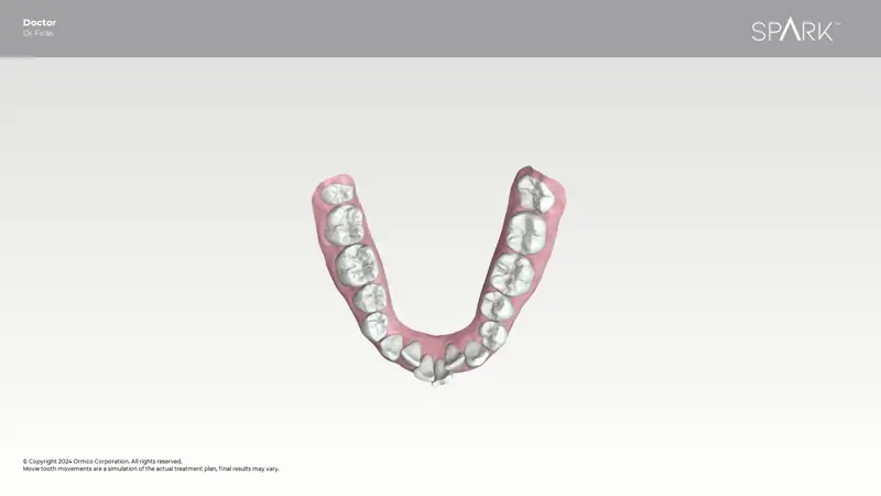 3D simulation of arch development